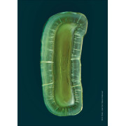 Elóra APS - сучасний наногібридний композит з унікальними можливостями Elóra APS - сучасний наногібридний композит з унікальними можливостями