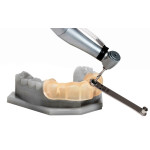 Шаблони з стоматологічної смоли DENTAL-SG, виготовлені на 3D принтері Шаблони з стоматологічної смоли DENTAL-SG, виготовлені на 3D принтері