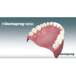Відео: Dentapreg MESH denture reinforcement - instructional video Відео: Dentapreg MESH denture reinforcement - instructional video