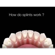 Видео: How Do Dental Splints Work 