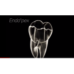 Відео: Endo @ pex - андрокомплекс, бездротовий Відео: Endo @ pex - андрокомплекс, бездротовий