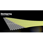 Відео: Відновлення колотого ріжучого краю за допомогою DENTAPRE® UFM  Відео: Відновлення колотого ріжучого краю за допомогою DENTAPRE® UFM