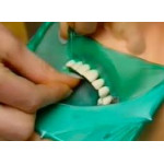 Відео: Система Раббердам Відео: Система Раббердам