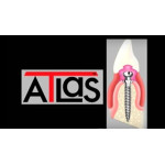 Відео: Нижньощелепний протез ATLAS Відео: Нижньощелепний протез ATLAS