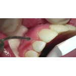 Відео: Сучасні технології VersaWave Відео: Сучасні технології VersaWave