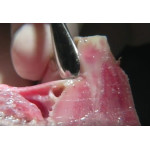 Відео: Ербієвий лазер VersaWave Відео: Ербієвий лазер VersaWave